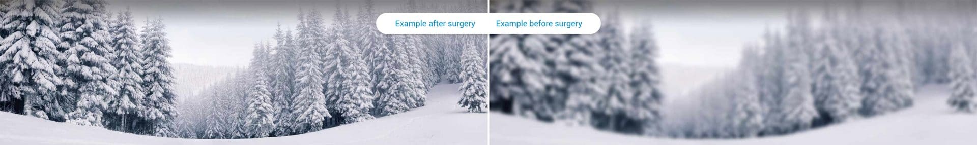 Astigmatism before and after