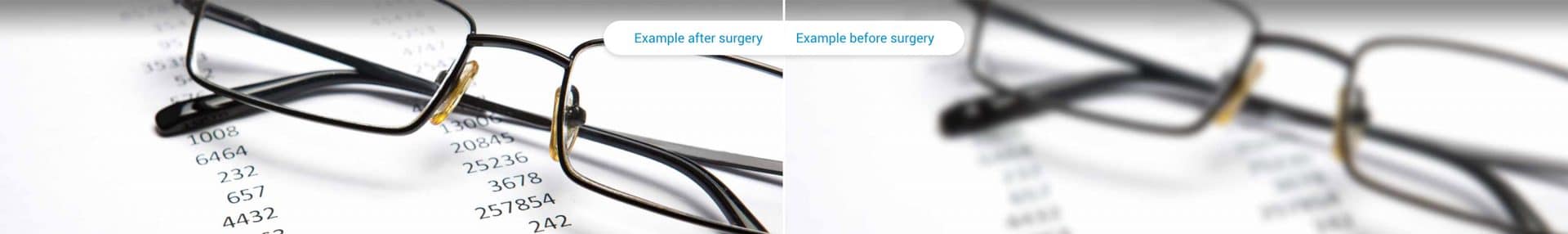 Presbyopia before and after