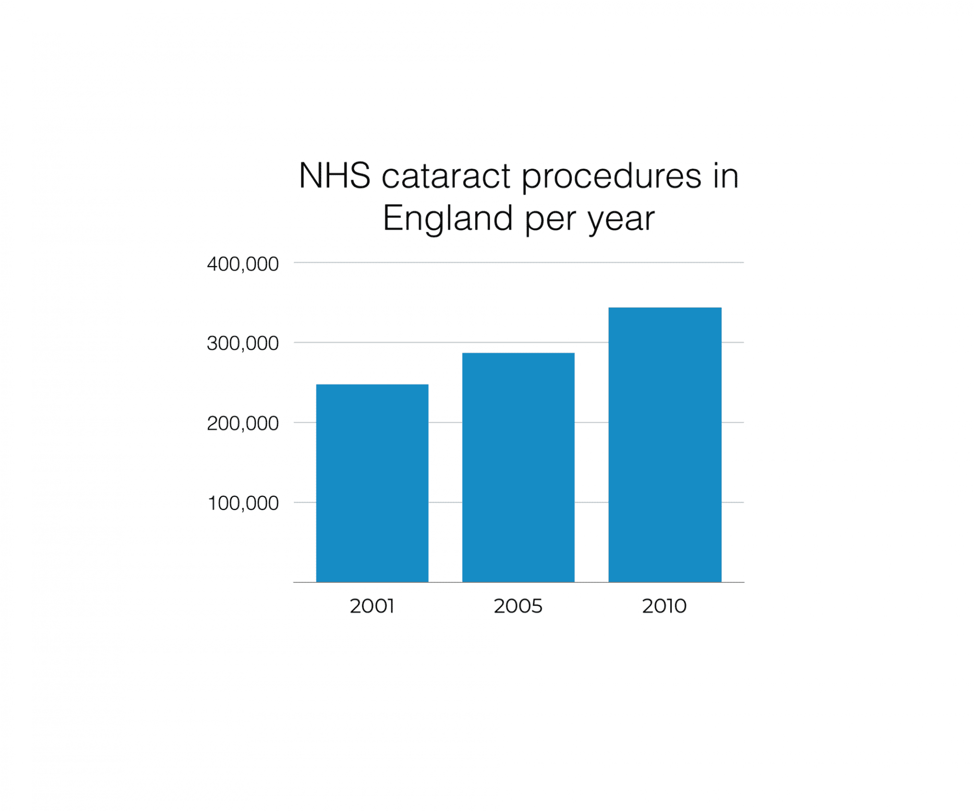 Chart showing NHS cataract procedures per year