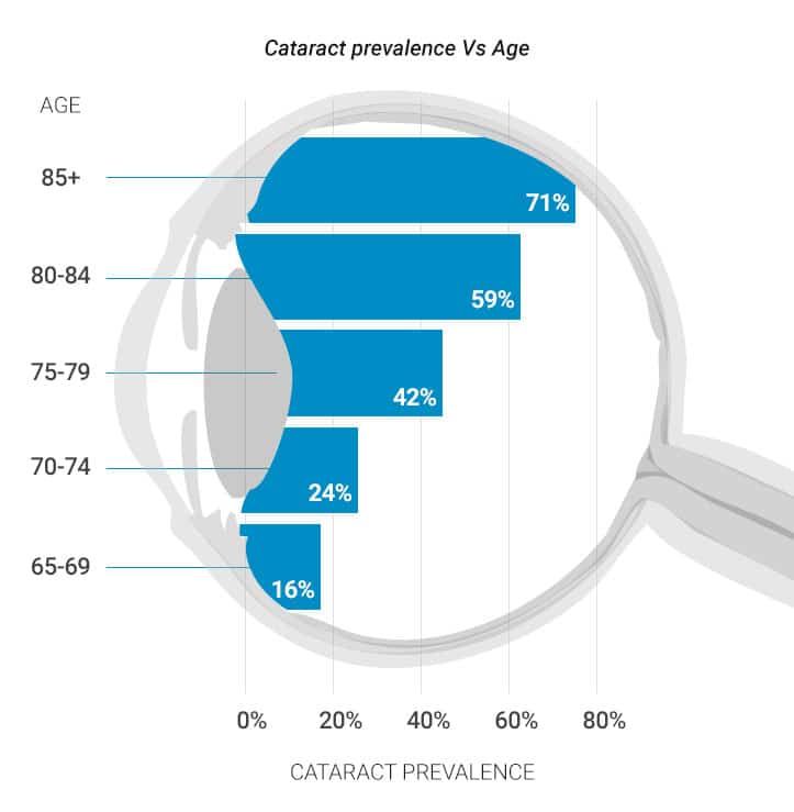 Chart showing cataract prevalence vs age