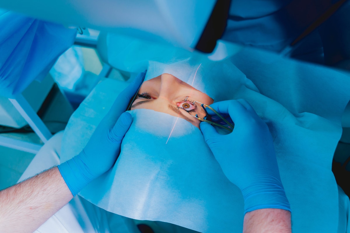 Are You Awake During Laser Eye Surgery?