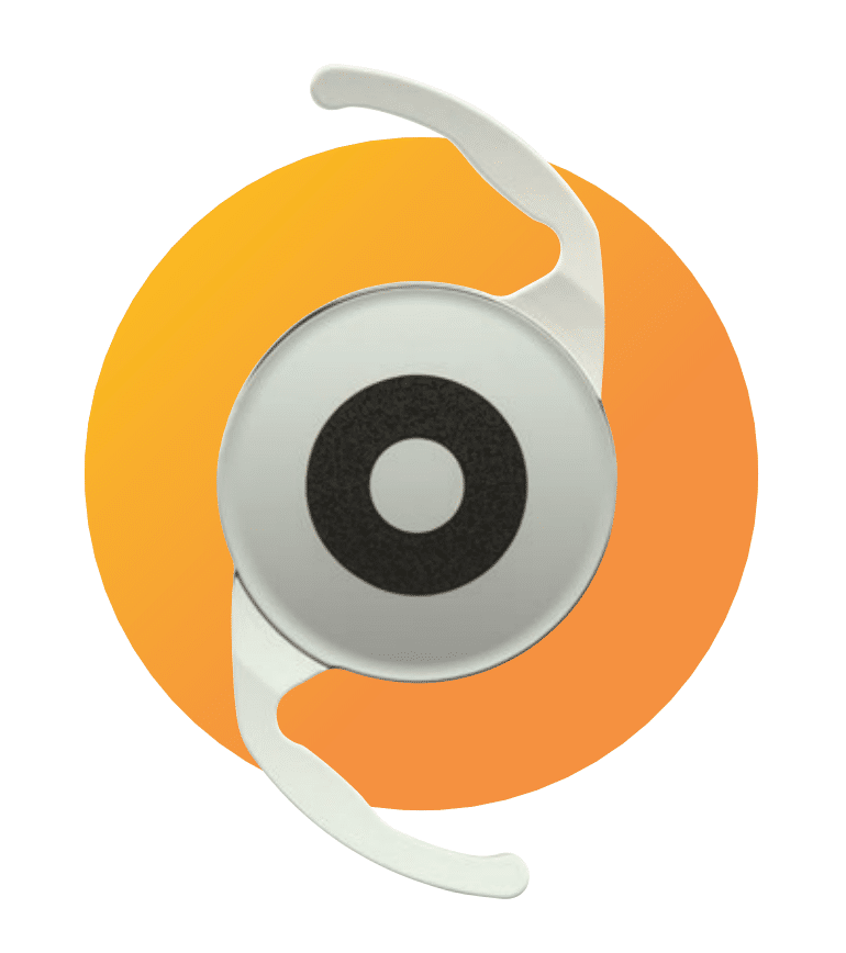 lens-right-for-me-5